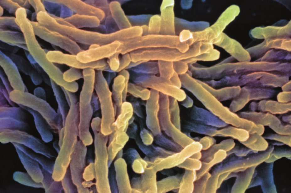 Anti-VEGF (vascular endothelial growth factor) therapies could help treat tuberculosis, research finds. In the image, SEM of tuberculosis bacteria.