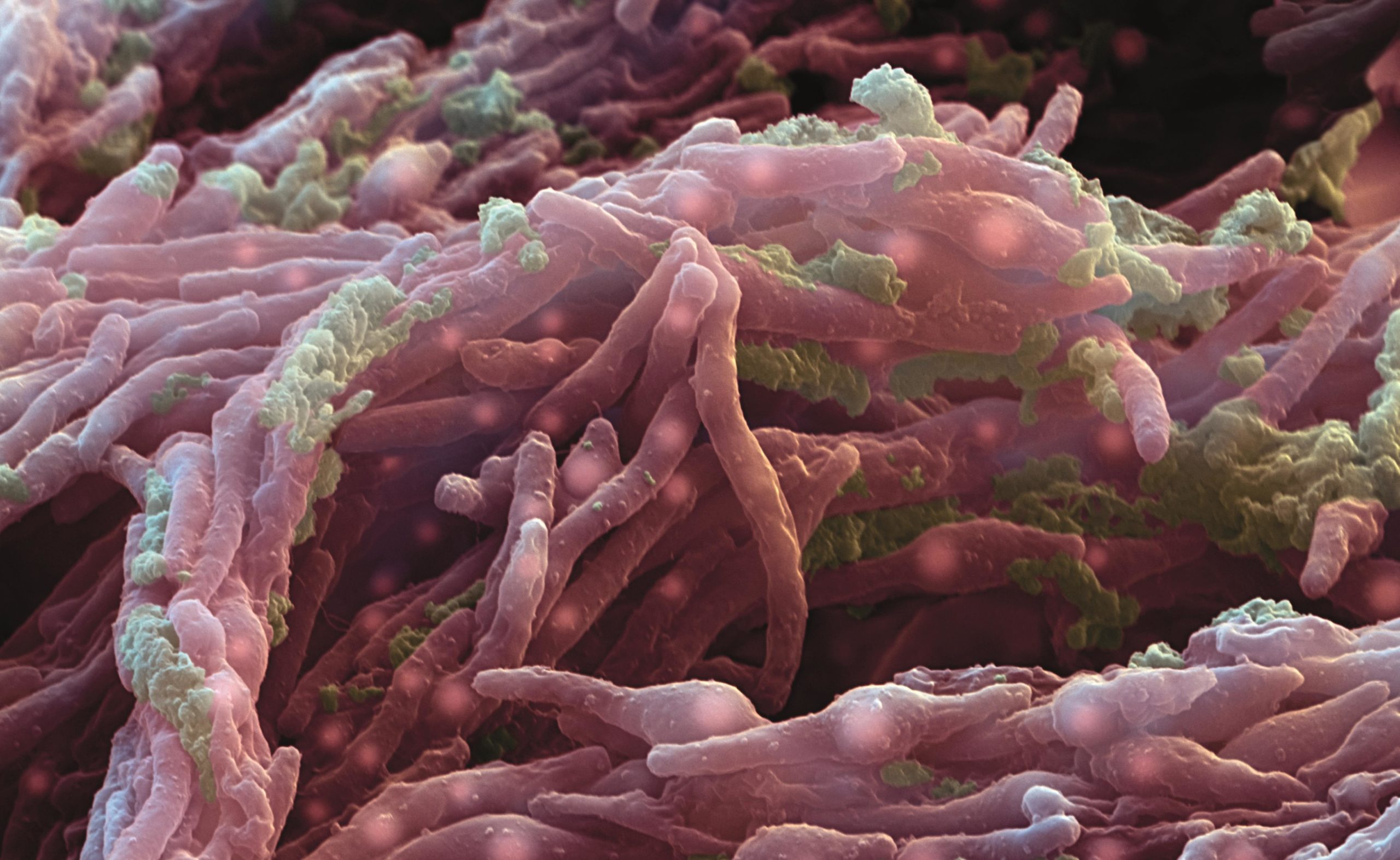 Новый вирус туберкулеза. Палочка Коха под микроскопом. Бактерии туберкулеза под микроскопом. Туберкулез бактериальное заболевание.