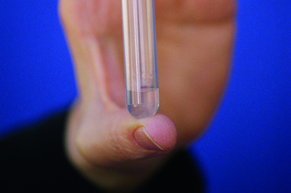Sample of male contraceptive gel, Vasalgel, in test tube