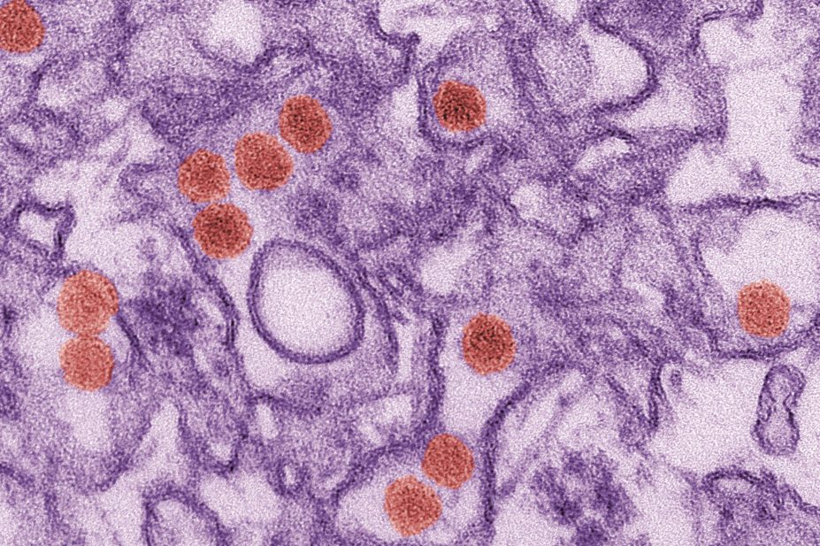 Micrograph of the Zika virus