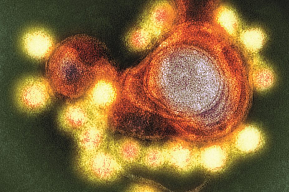 Micrograph of Zika virus particles