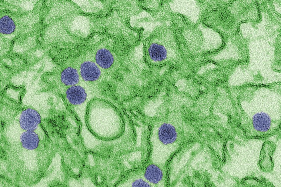 Digitally-colorized transmission electron micrograph (TEM) of the Zika virus. Virus particles, here colored blue, are 40 nm in diameter, with an outer envelope, and an inner dense core