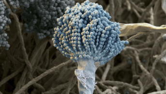 Aspergillus fungus conidiophoresSEM