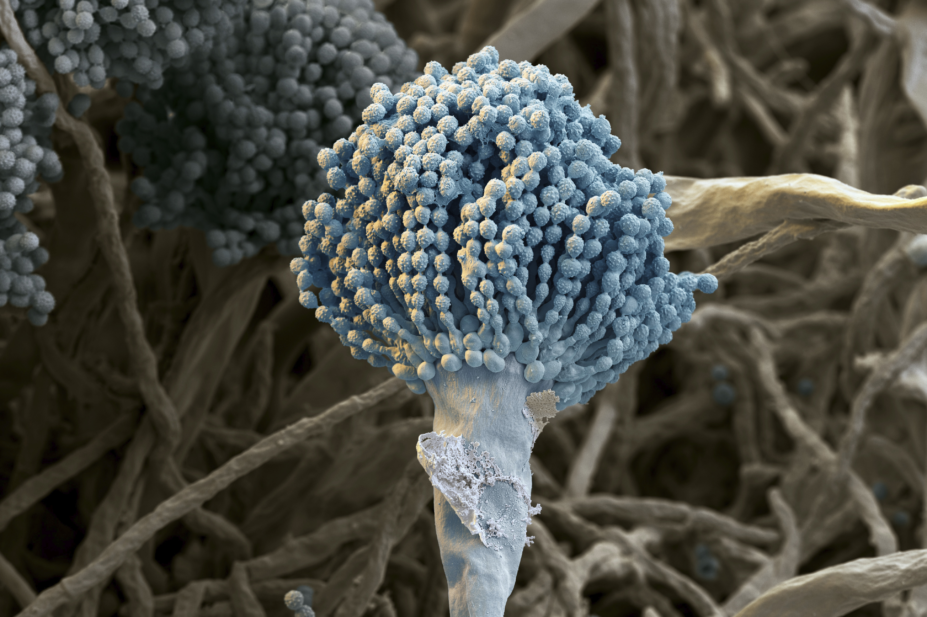 A coloured scanning electron micrograph Aspergillus fumigatus conidiophores