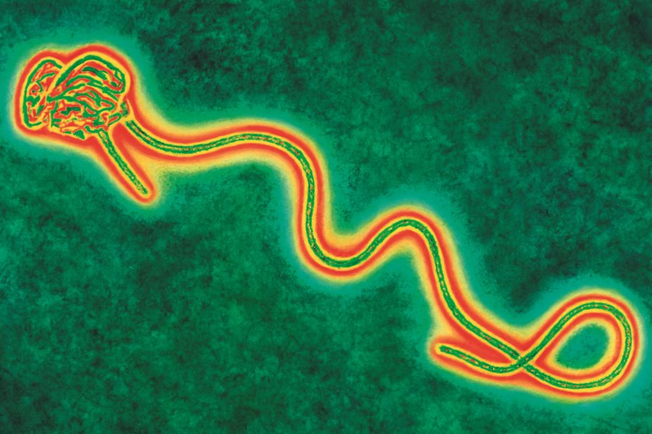 Chinese researchers have developed a recombinant adenovirus type-5 vector-based Ebola vaccine that expresses the envelope glycoprotein from the 2014 epidemic strain. In the image, a scanned electron micrograph of the Ebola virus