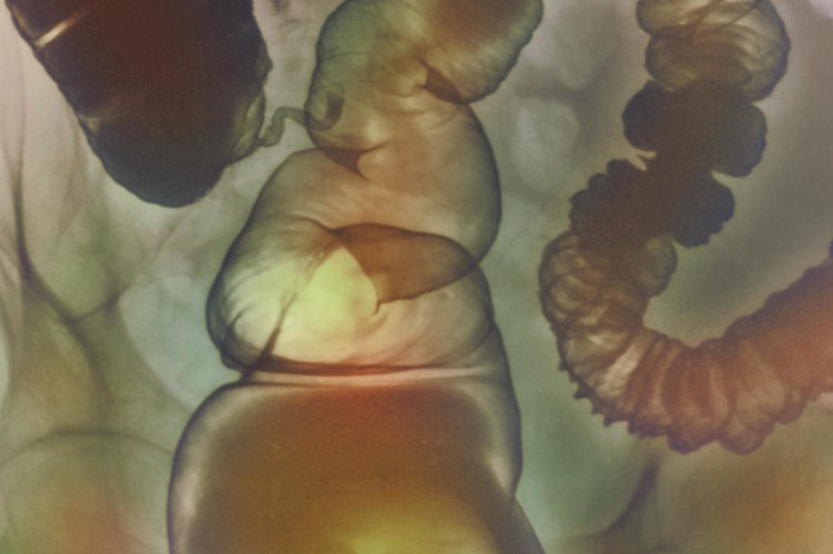 Researchers say that H1 antihistamines could therefore be explored as a new treatment approach in irritable bowel syndrome (IBS), x-ray pictured