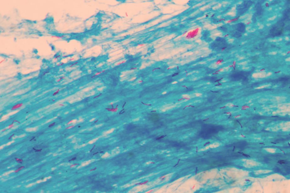 Micrograph of tuberculosis bacteria