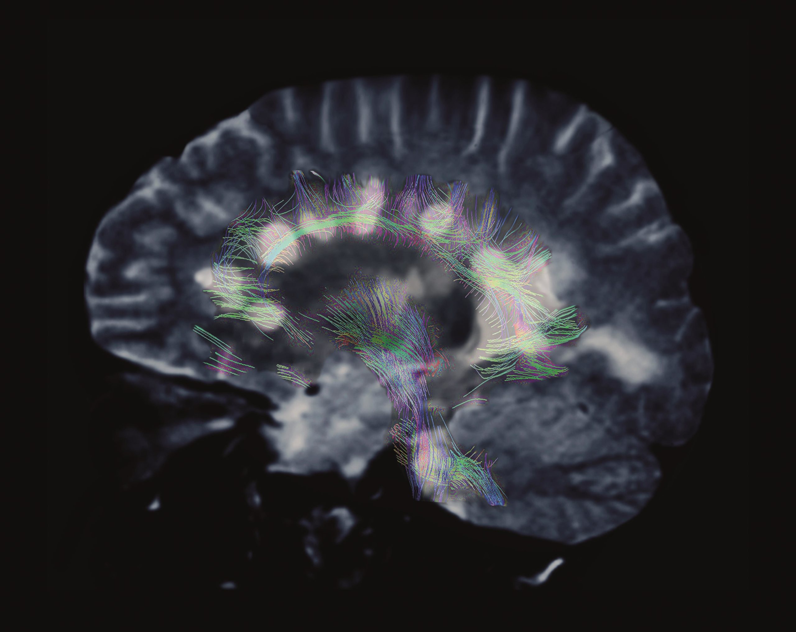 Tizanidine interactions The Pharmaceutical Journal