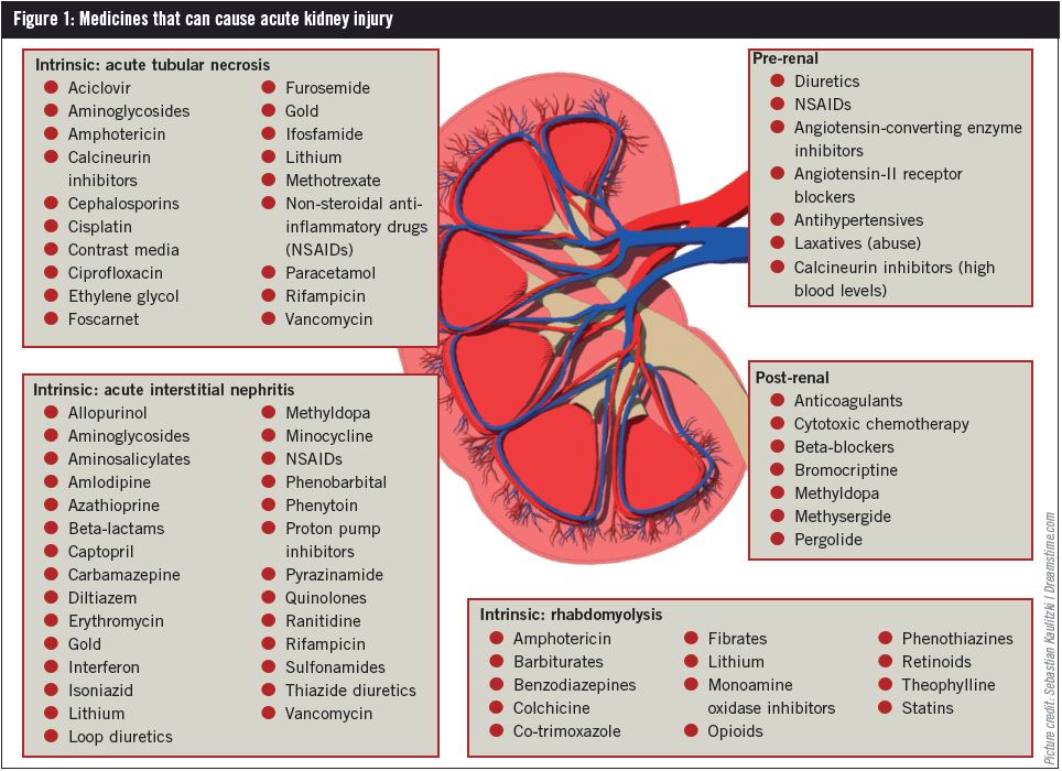 Acute Kidney Injury Diagnosis Staging And Prevention The