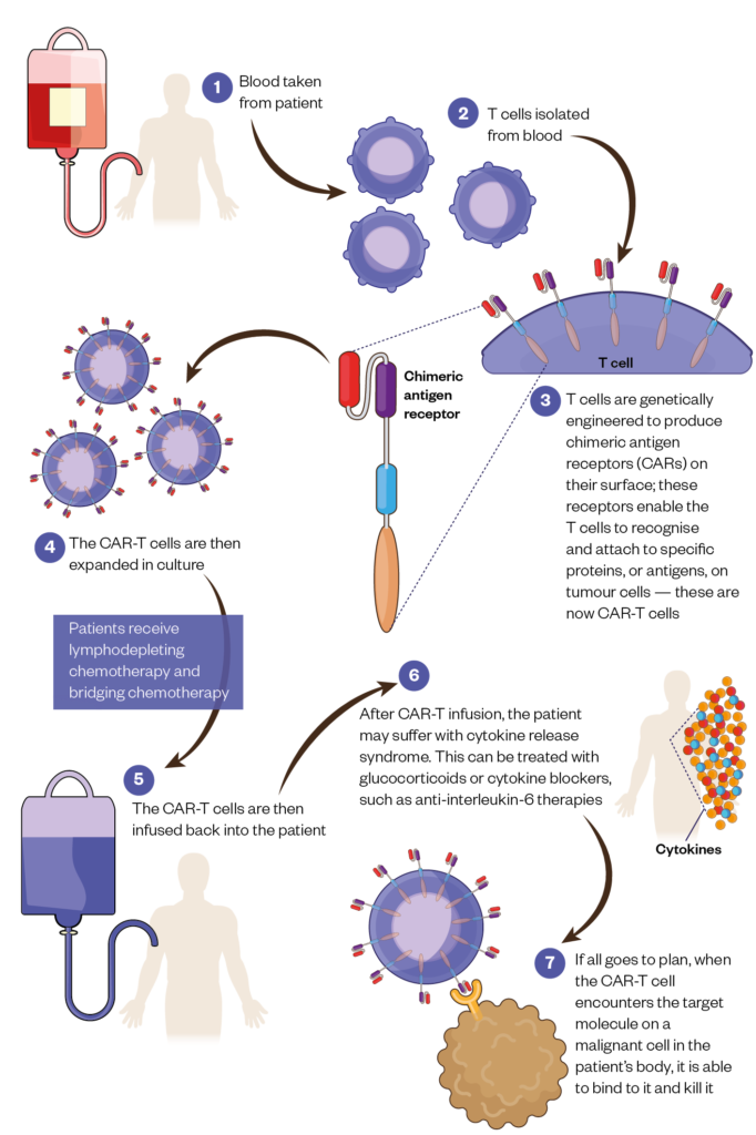 The process of CAR-T cell therapy