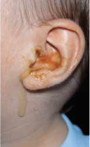 Outer and middle ear problems - The Pharmaceutical Journal