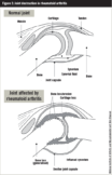 Rheumatoid arthritis: features, causes and diagnosis - The ...