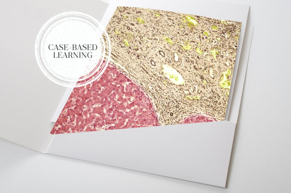 Photo of a section of liver tissue in a file folder