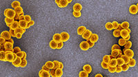 Electron microscope image of methicillin resistant Staphylococcus aureus.