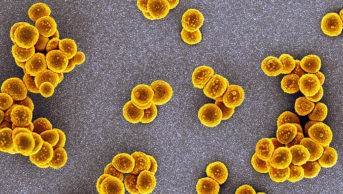 Electron microscope image of methicillin resistant Staphylococcus aureus.