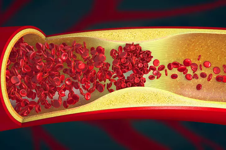 How pharmacists have taken over the care of venous thromboembolism ...