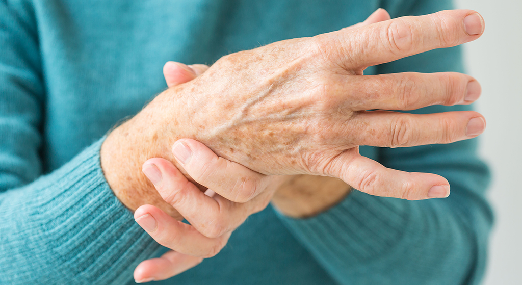 Carpal tunnel syndrome: identification and management - The Pharmaceutical  Journal