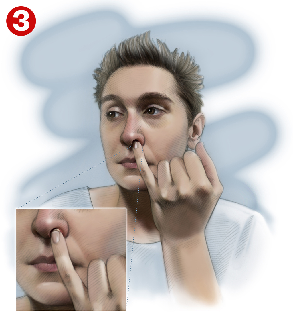 Image 3: Applying nasal ointment using little finger
