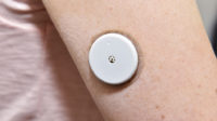Close-up of a blood glucose monitor on the arm of a female patient