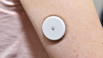 Close-up of a blood glucose monitor on the arm of a female patient