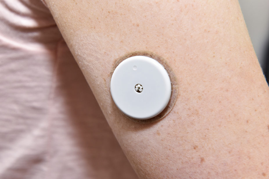 Close-up of a blood glucose monitor on the arm of a female patient