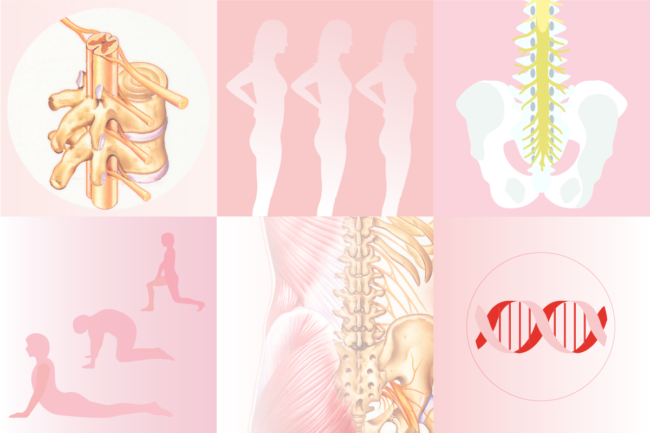 Getting back on track: management of lower back pain - The ...
