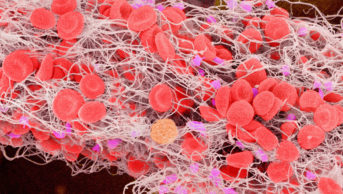 Coloured scanning electron micrograph (SEM) of a blood clot