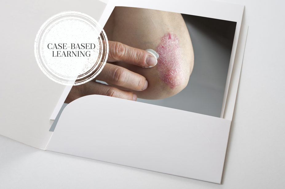 Picture of finger pointing to plaque psoriasis on the elbow in a file folder