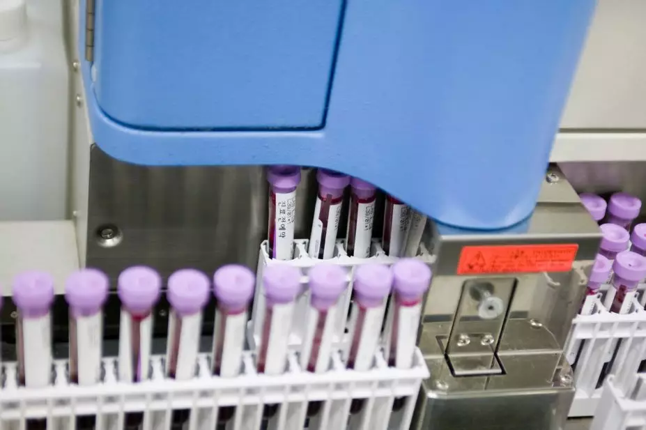 Blood samples processed through an automated blood analysis machine.