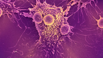 T cells (smaller round cells) attached to a cancer cell