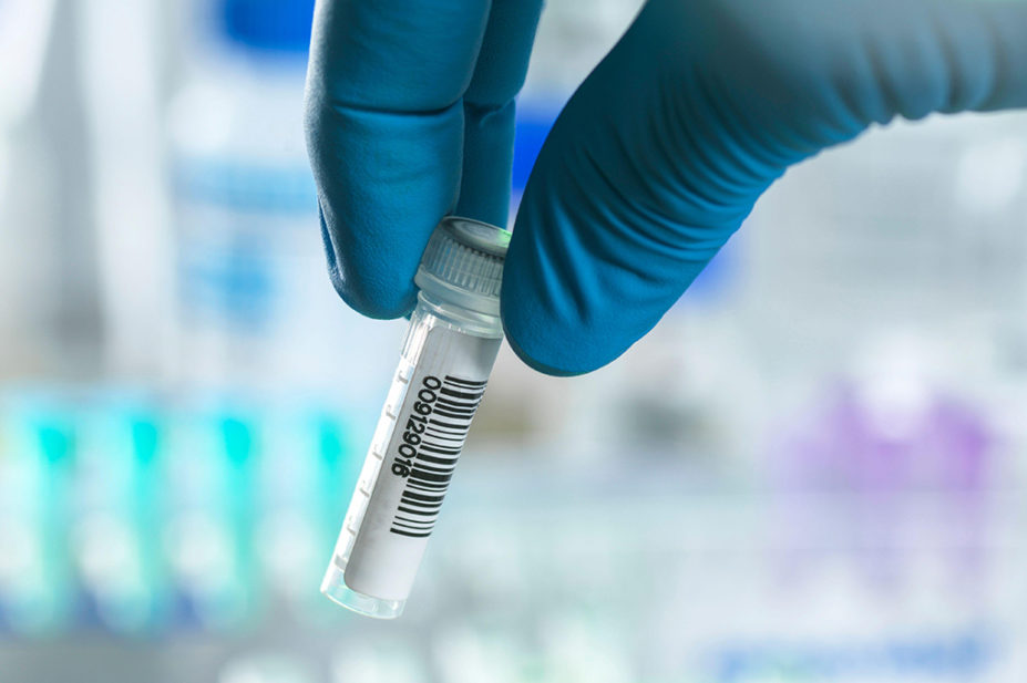 Scientist preparing DNA samples for testing in a laboratory