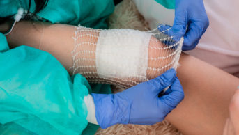 Doctor puts a bandage on the patient's knee with an elastic tubular mesh