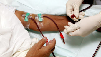 Support nurse taking renal outpatient off dialysis