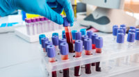 blood samples in test tubes