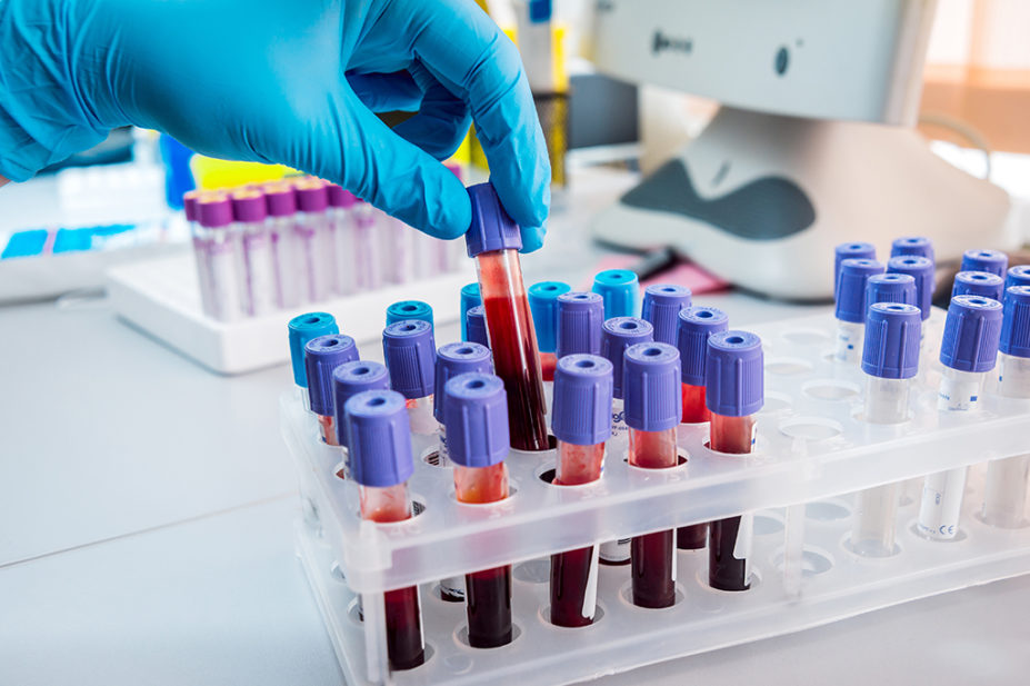 blood samples in test tubes
