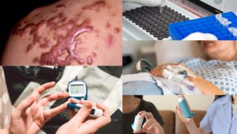 collage of keloid scar, diabetes pin prick test,