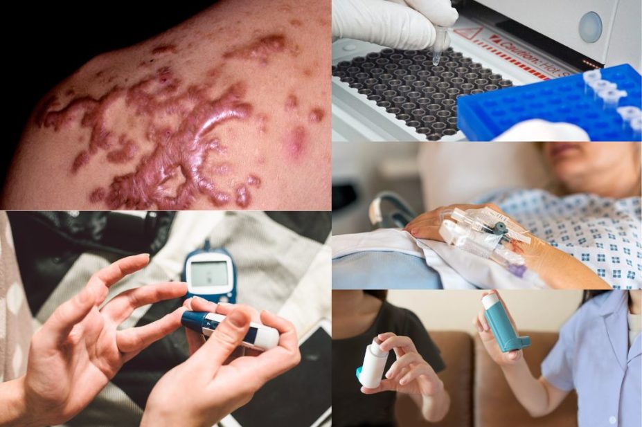 collage of keloid scar, diabetes pin prick test,