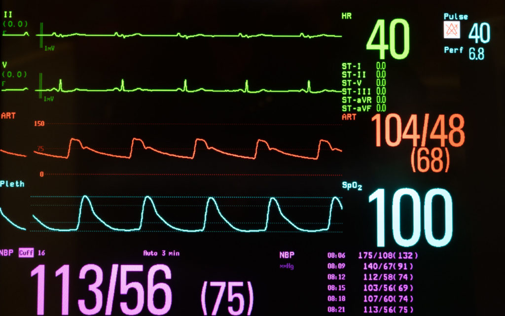 digoxin-monitoring-and-toxicity-management-the-pharmaceutical-journal