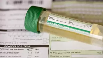 A Chlamydia self testing kit