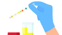 Illustration of a hand holding a dipstick urine test