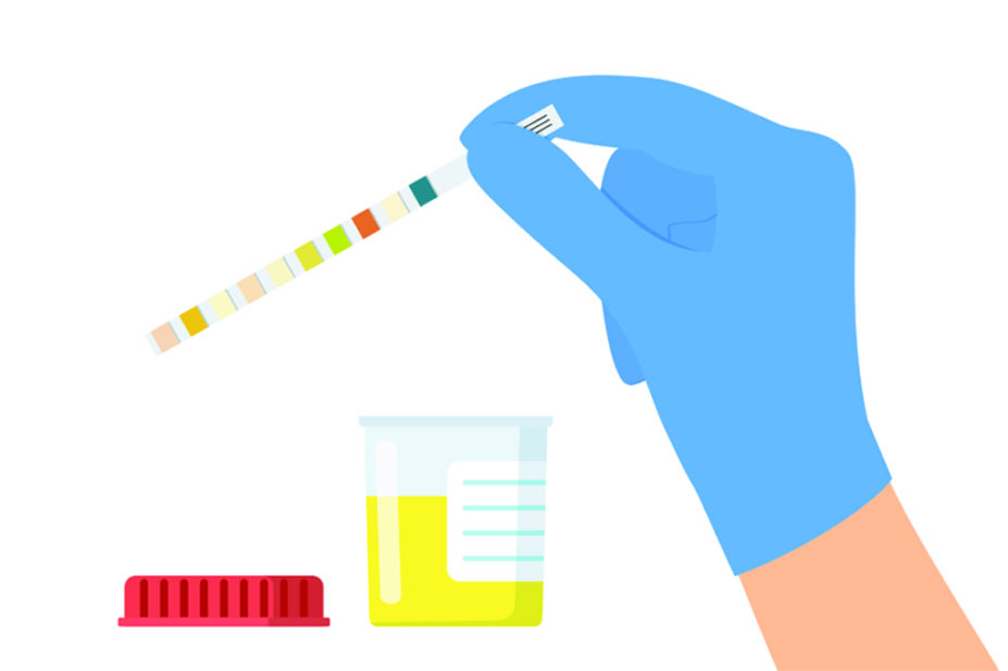 Illustration of a hand holding a dipstick urine test