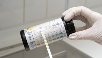 urine dipstick test being held against colour chart