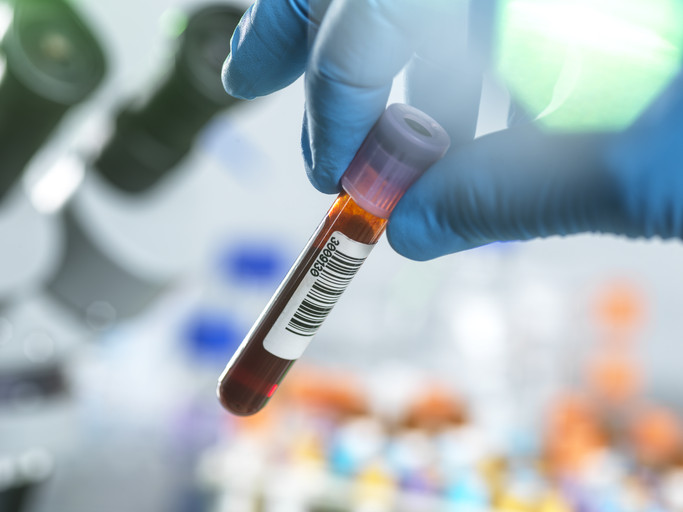 Blood test being held by clinician