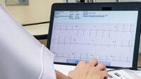 person viewing ecg reading on screen