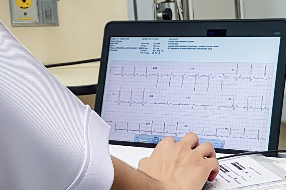 person viewing ecg reading on screen