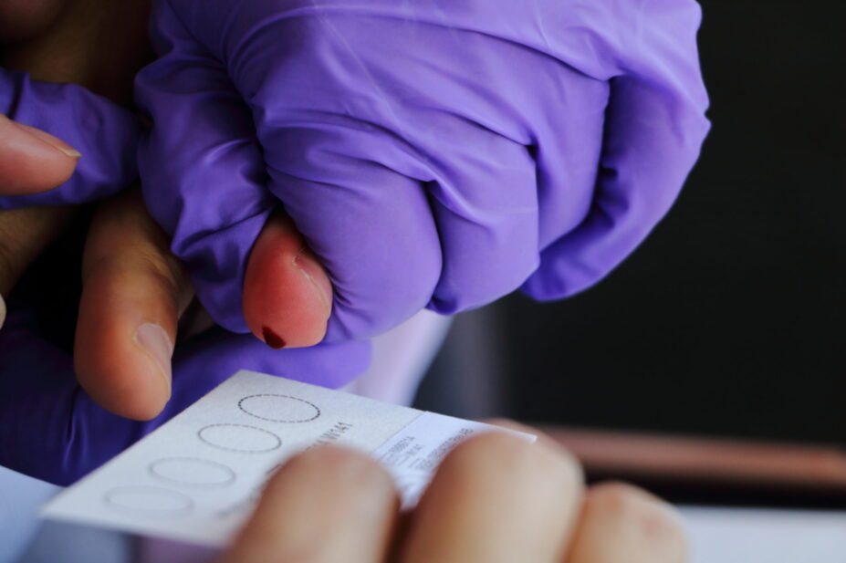 Photograph demonstrating a dry blood spot test for Hepatitis C being performed