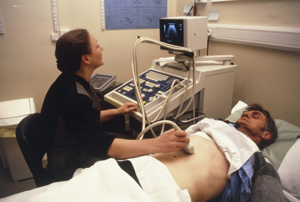 Man undergoing an abdominal ultrasound scan