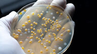 petri dish showing bacteria drug resistance