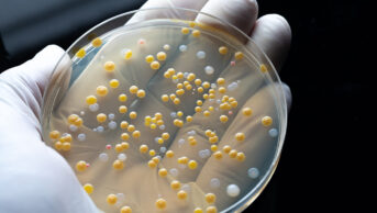 petri dish showing bacteria drug resistance