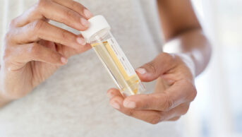 woman holding urine sample
